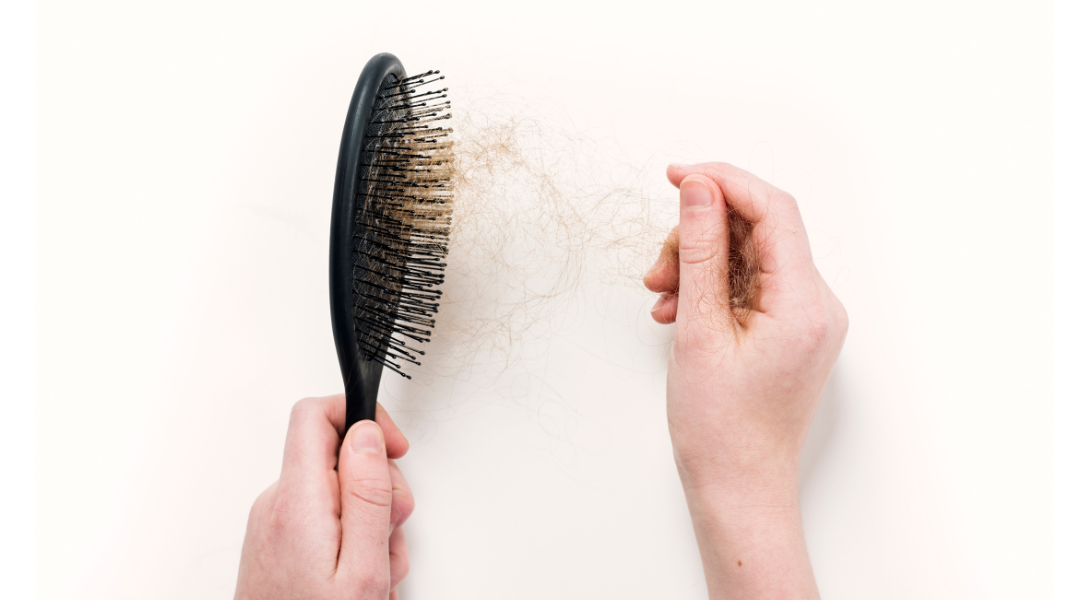 Descubre los distintos tipos de alopecia: Un vistazo a las diversas formas de pérdida de cabello